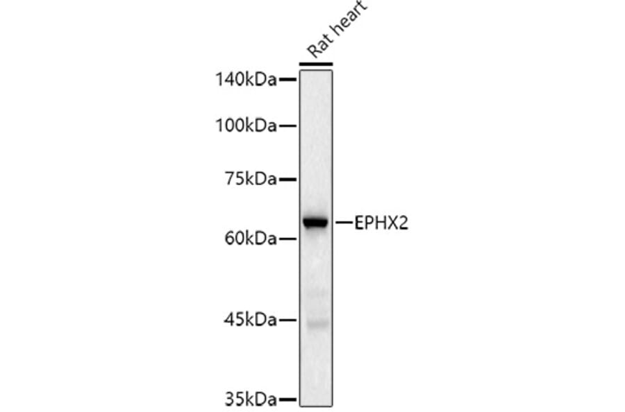 Western Blot - Anti-EPHX2 Antibody [ARC2895] (A307925) - Antibodies.com
