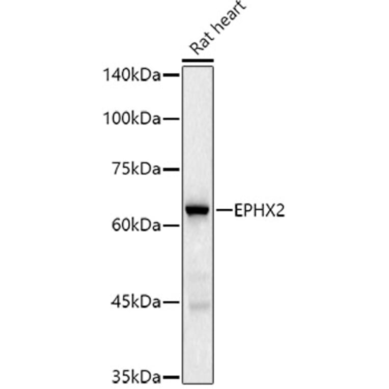 Western Blot - Anti-EPHX2 Antibody [ARC2895] (A307925) - Antibodies.com