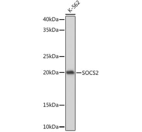Western Blot - Anti-SOCS2 Antibody [ARC1470] (A307926) - Antibodies.com