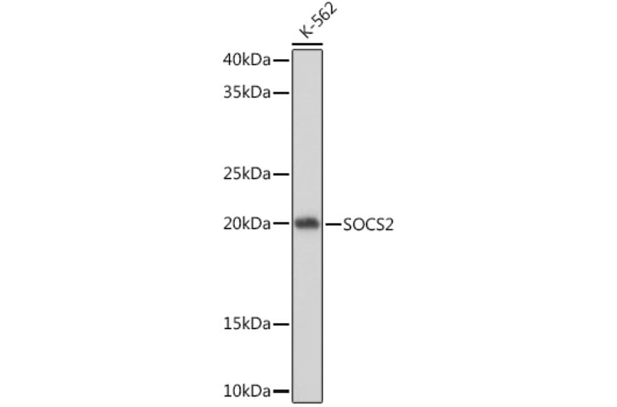 Western Blot - Anti-SOCS2 Antibody [ARC1470] (A307926) - Antibodies.com