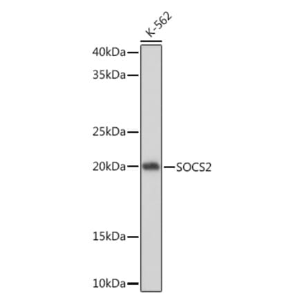 Western Blot - Anti-SOCS2 Antibody [ARC1470] (A307926) - Antibodies.com