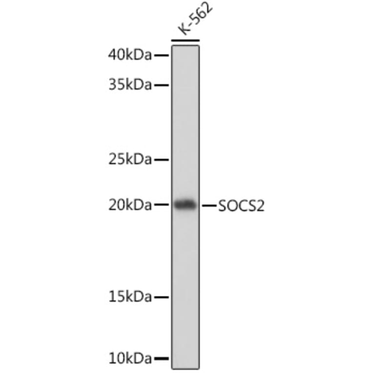 Western Blot - Anti-SOCS2 Antibody [ARC1470] (A307926) - Antibodies.com