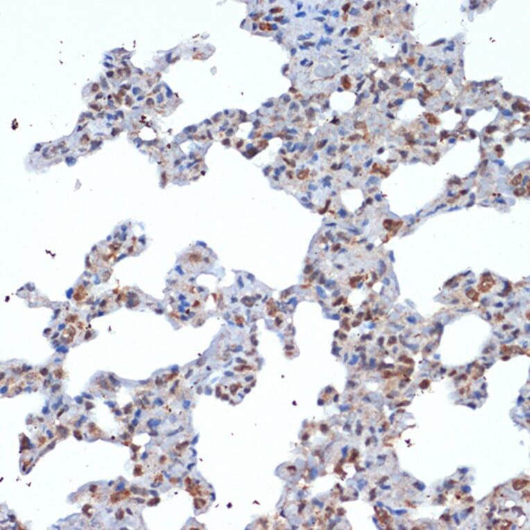 Immunohistochemistry - Anti-SOCS2 Antibody [ARC1470] (A307926) - Antibodies.com