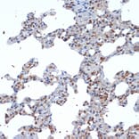 Immunohistochemistry - Anti-SOCS2 Antibody [ARC1470] (A307926) - Antibodies.com