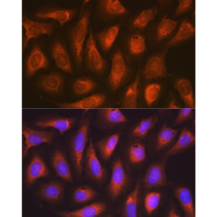 Immunofluorescence - Anti-SOCS2 Antibody [ARC1470] (A307926) - Antibodies.com