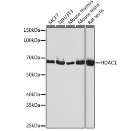 Western Blot - Anti-HDAC1 Antibody [ARC0050] (A307930) - Antibodies.com