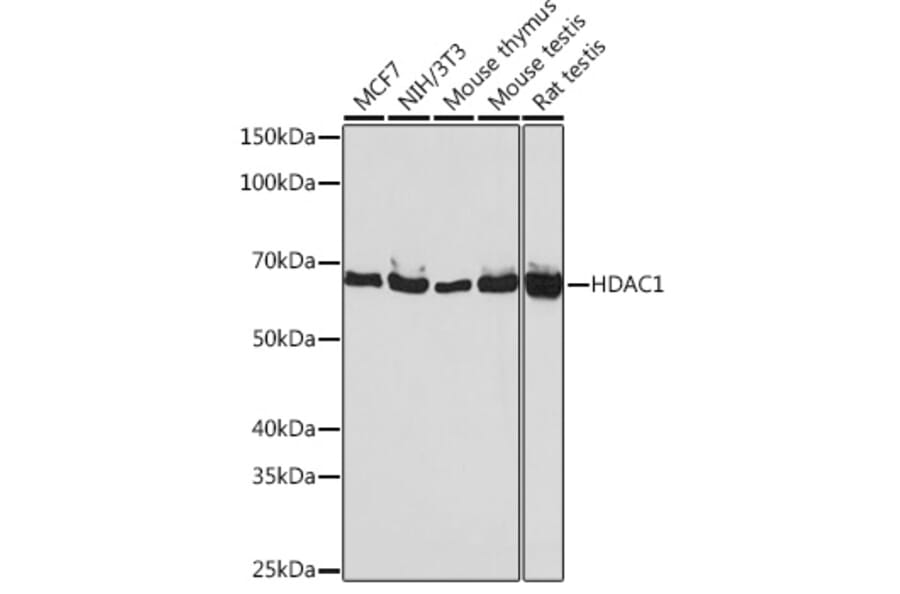 Western Blot - Anti-HDAC1 Antibody [ARC0050] (A307930) - Antibodies.com