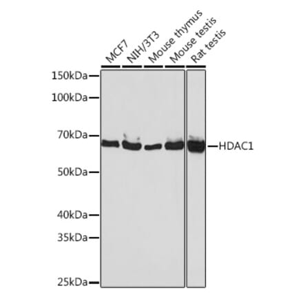 Western Blot - Anti-HDAC1 Antibody [ARC0050] (A307930) - Antibodies.com