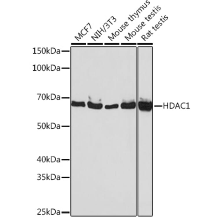 Western Blot - Anti-HDAC1 Antibody [ARC0050] (A307930) - Antibodies.com