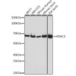 Western Blot - Anti-HDAC1 Antibody [ARC0050] (A307930) - Antibodies.com