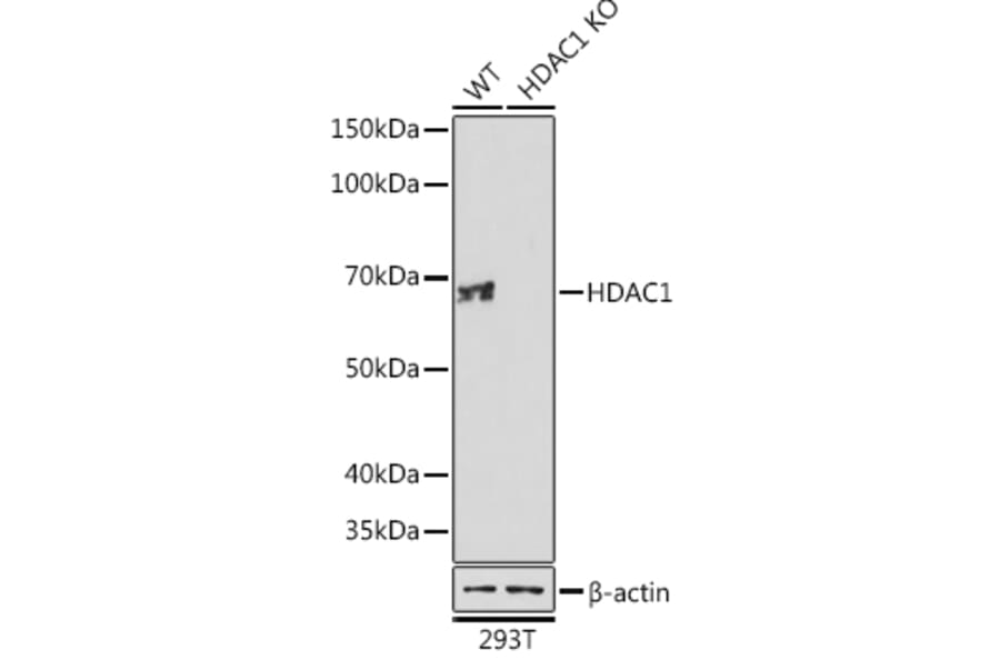 Western Blot - Anti-HDAC1 Antibody [ARC0050] (A307930) - Antibodies.com