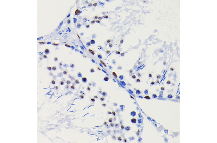 Immunohistochemistry - Anti-HDAC1 Antibody [ARC0050] (A307930) - Antibodies.com