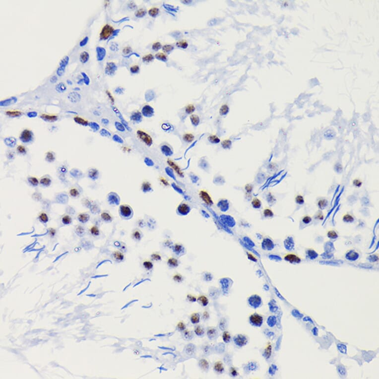 Immunohistochemistry - Anti-HDAC1 Antibody [ARC0050] (A307930) - Antibodies.com