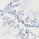 Immunohistochemistry - Anti-HDAC1 Antibody [ARC0050] (A307930) - Antibodies.com