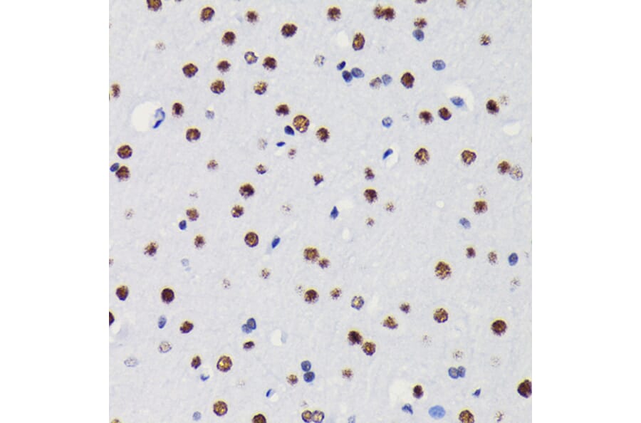 Immunohistochemistry - Anti-HDAC1 Antibody [ARC0050] (A307930) - Antibodies.com