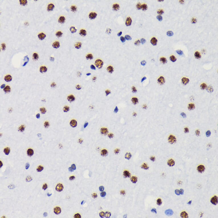 Immunohistochemistry - Anti-HDAC1 Antibody [ARC0050] (A307930) - Antibodies.com