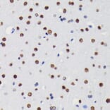 Immunohistochemistry - Anti-HDAC1 Antibody [ARC0050] (A307930) - Antibodies.com