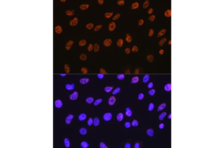 Immunofluorescence - Anti-HDAC1 Antibody [ARC0050] (A307930) - Antibodies.com