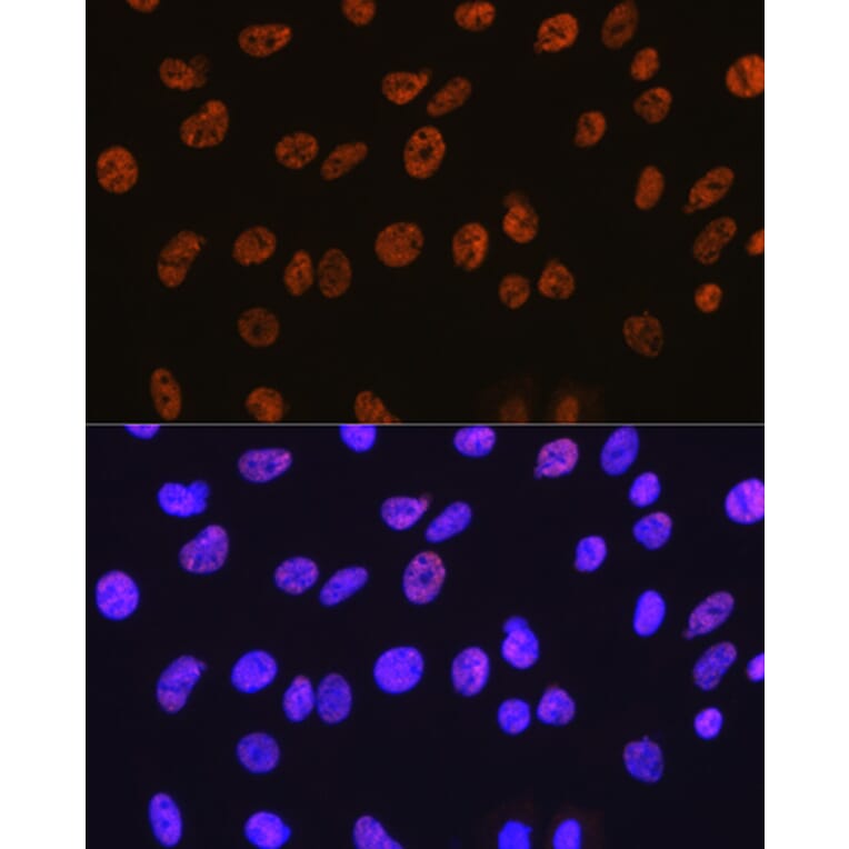Immunofluorescence - Anti-HDAC1 Antibody [ARC0050] (A307930) - Antibodies.com