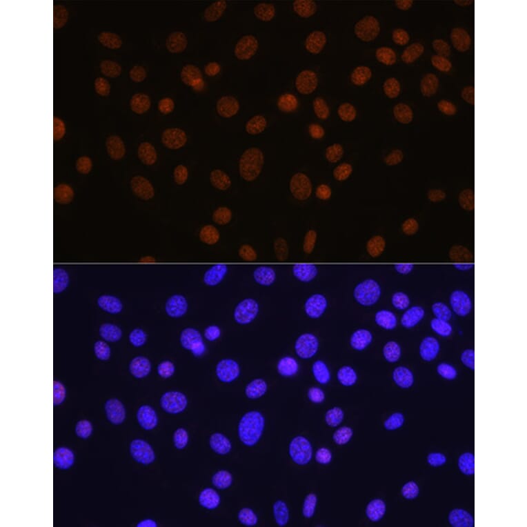 Immunofluorescence - Anti-HDAC1 Antibody [ARC0050] (A307930) - Antibodies.com