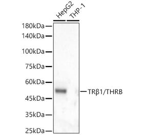 Western Blot - Anti-Thyroid Hormone Receptor beta Antibody [ARC56361] (A307931) - Antibodies.com