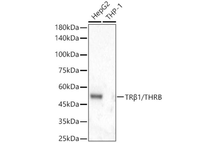 Western Blot - Anti-Thyroid Hormone Receptor beta Antibody [ARC56361] (A307931) - Antibodies.com
