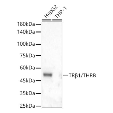 Western Blot - Anti-Thyroid Hormone Receptor beta Antibody [ARC56361] (A307931) - Antibodies.com