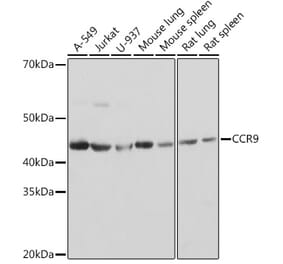 Western Blot - Anti-CCR9 Antibody [ARC1706] (A307933) - Antibodies.com