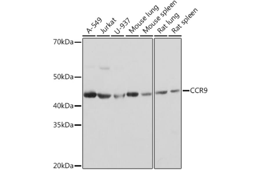 Western Blot - Anti-CCR9 Antibody [ARC1706] (A307933) - Antibodies.com