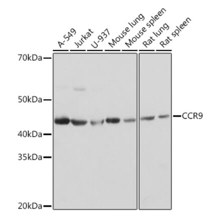 Western Blot - Anti-CCR9 Antibody [ARC1706] (A307933) - Antibodies.com