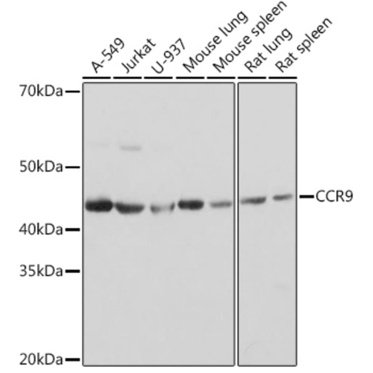 Western Blot - Anti-CCR9 Antibody [ARC1706] (A307933) - Antibodies.com