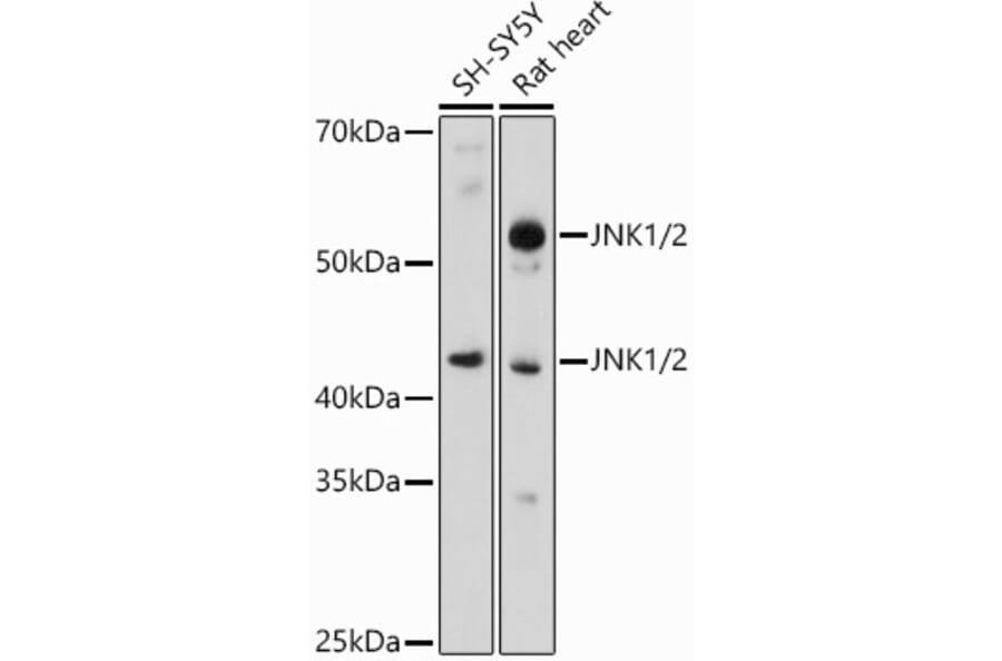 Western Blot - Anti-JNK1 + JNK2 Antibody (A307935) - Antibodies.com