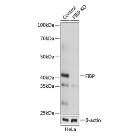 Western Blot - Anti-FIBP Antibody (A307937) - Antibodies.com