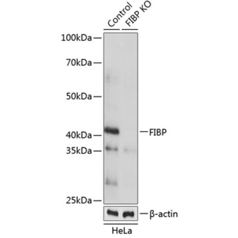 Western Blot - Anti-FIBP Antibody (A307937) - Antibodies.com