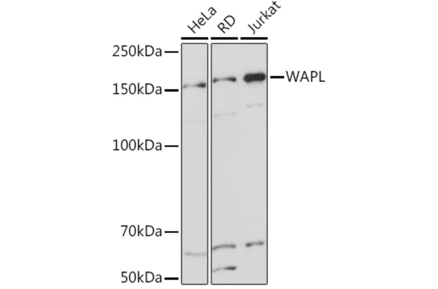Western Blot - Anti-WAPL/FOE Antibody [ARC2088] (A307938) - Antibodies.com