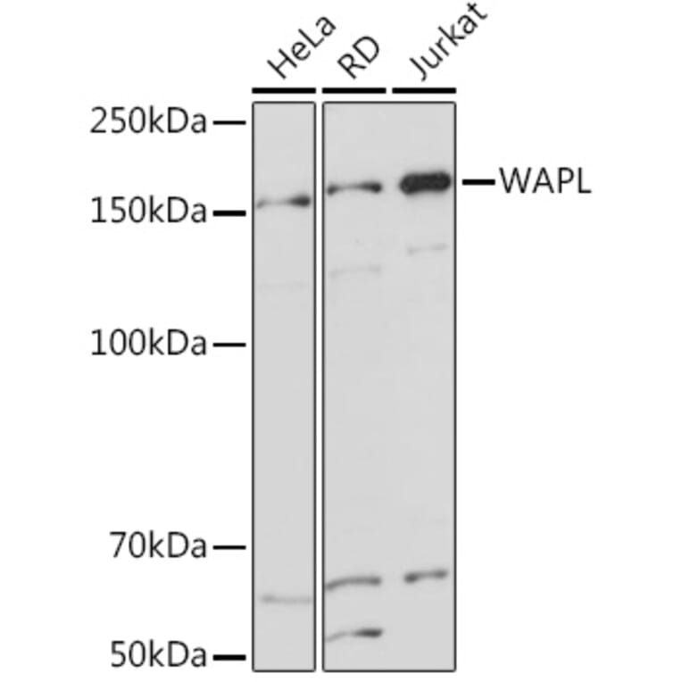 Western Blot - Anti-WAPL/FOE Antibody [ARC2088] (A307938) - Antibodies.com