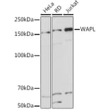Western Blot - Anti-WAPL/FOE Antibody [ARC2088] (A307938) - Antibodies.com