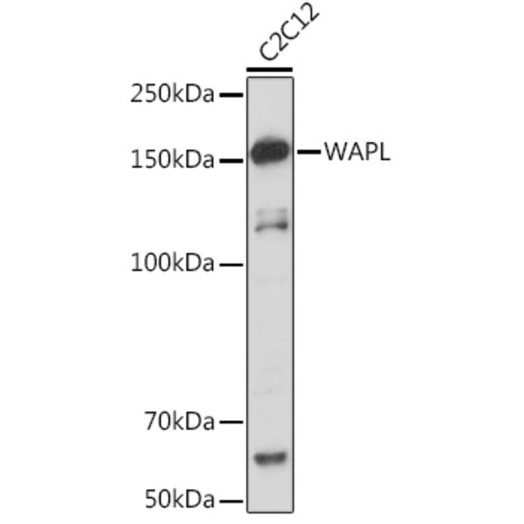 Western Blot - Anti-WAPL/FOE Antibody [ARC2088] (A307938) - Antibodies.com