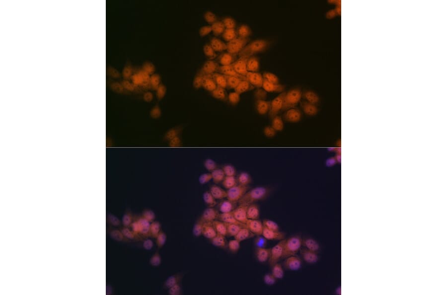 Immunofluorescence - Anti-WAPL/FOE Antibody [ARC2088] (A307938) - Antibodies.com