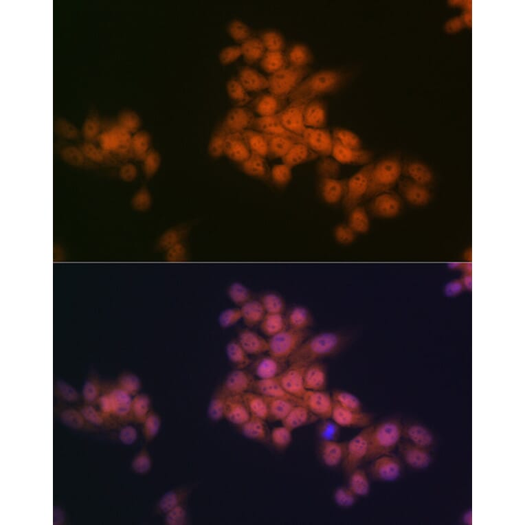 Immunofluorescence - Anti-WAPL/FOE Antibody [ARC2088] (A307938) - Antibodies.com