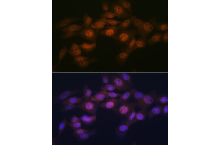 Immunofluorescence - Anti-WAPL/FOE Antibody [ARC2088] (A307938) - Antibodies.com