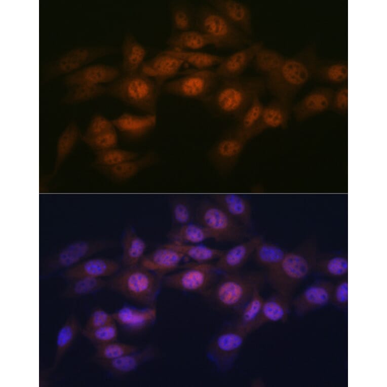 Immunofluorescence - Anti-WAPL/FOE Antibody [ARC2088] (A307938) - Antibodies.com