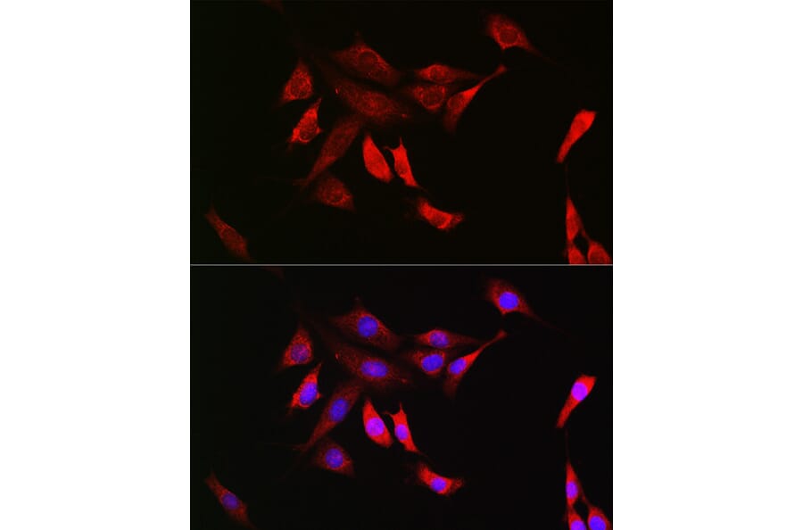 Immunofluorescence - Anti-SHP2 Antibody [ARC2635] (A307939) - Antibodies.com