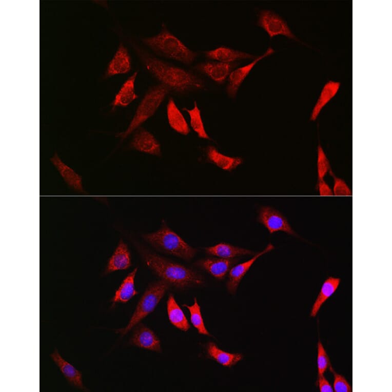 Immunofluorescence - Anti-SHP2 Antibody [ARC2635] (A307939) - Antibodies.com