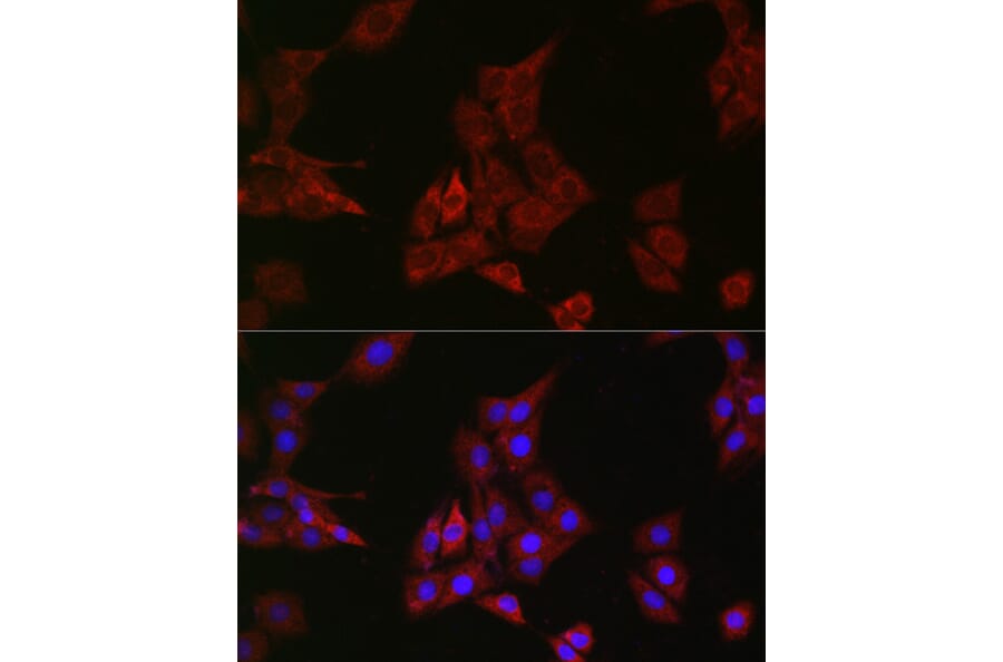 Immunofluorescence - Anti-SHP2 Antibody [ARC2635] (A307939) - Antibodies.com
