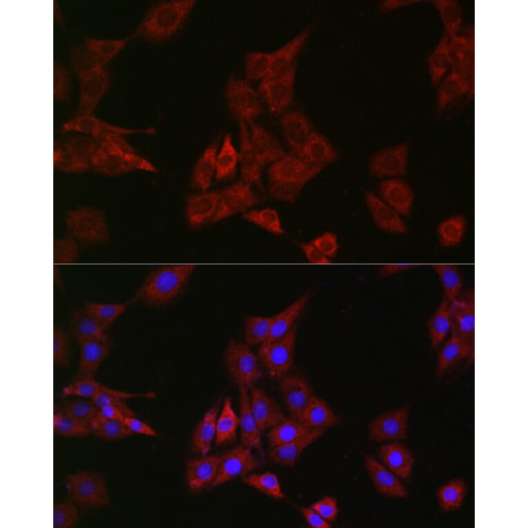 Immunofluorescence - Anti-SHP2 Antibody [ARC2635] (A307939) - Antibodies.com