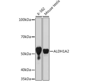 Western Blot - Anti-ALDH1A2 Antibody [ARC1797] (A307940) - Antibodies.com