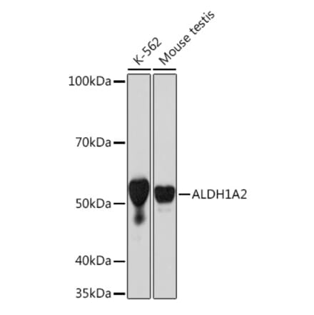 Western Blot - Anti-ALDH1A2 Antibody [ARC1797] (A307940) - Antibodies.com