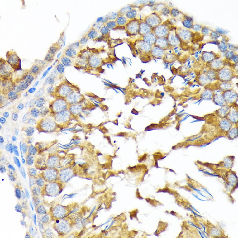 Immunohistochemistry - Anti-ALDH1A2 Antibody [ARC1797] (A307940) - Antibodies.com