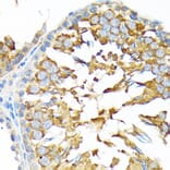 Immunohistochemistry - Anti-ALDH1A2 Antibody [ARC1797] (A307940) - Antibodies.com